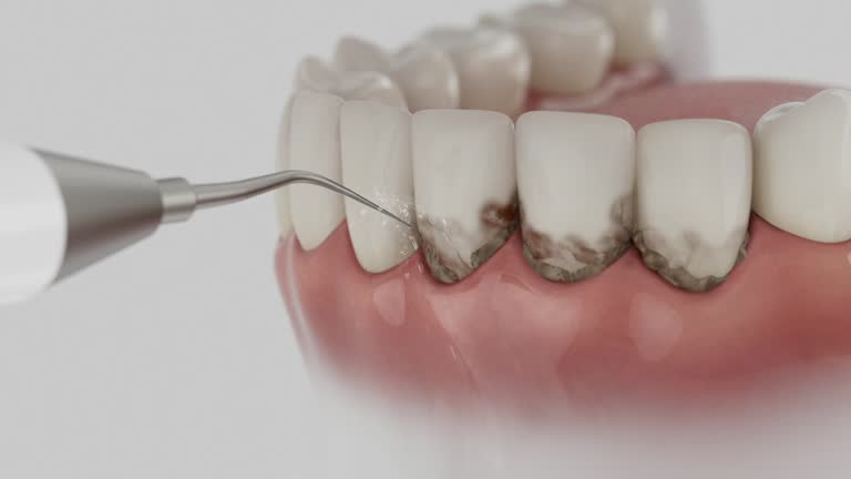 Reliable Teeth Cleaning And Checkup contractor in Clark County County, KY by Dentist Open Now